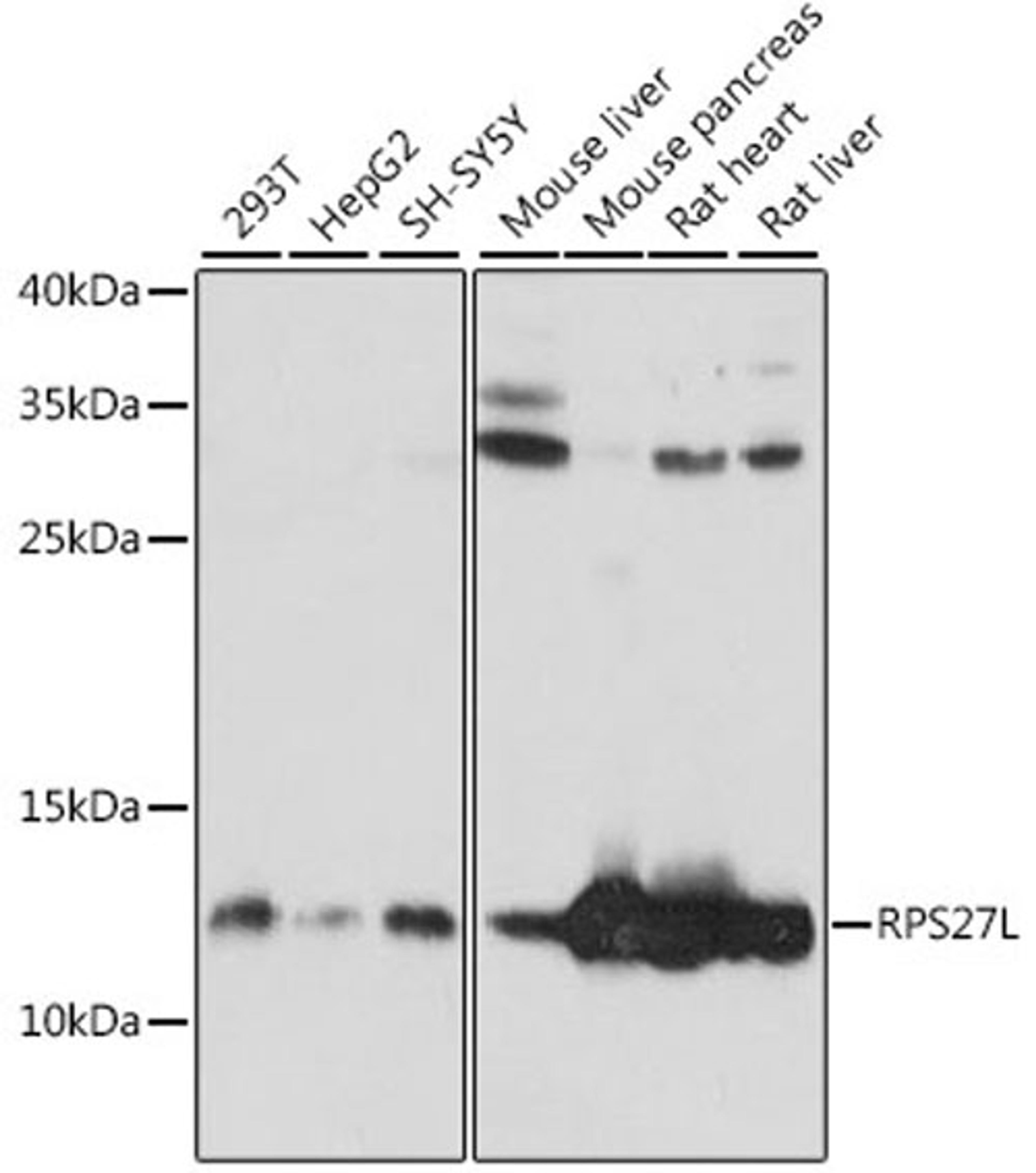 Western blot - RPS27L antibody (A15833)