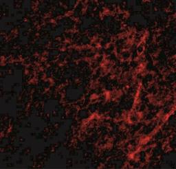 Immunocytochemistry/Immunofluorescence: AIFM3 Antibody [NBP1-76889] - Immunofluorescence of AIFM3 in human brain tissue with AIFM3 antibody at 20 ug/mL.