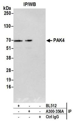 Detection of human PAK4 by western blot of immunoprecipitates.