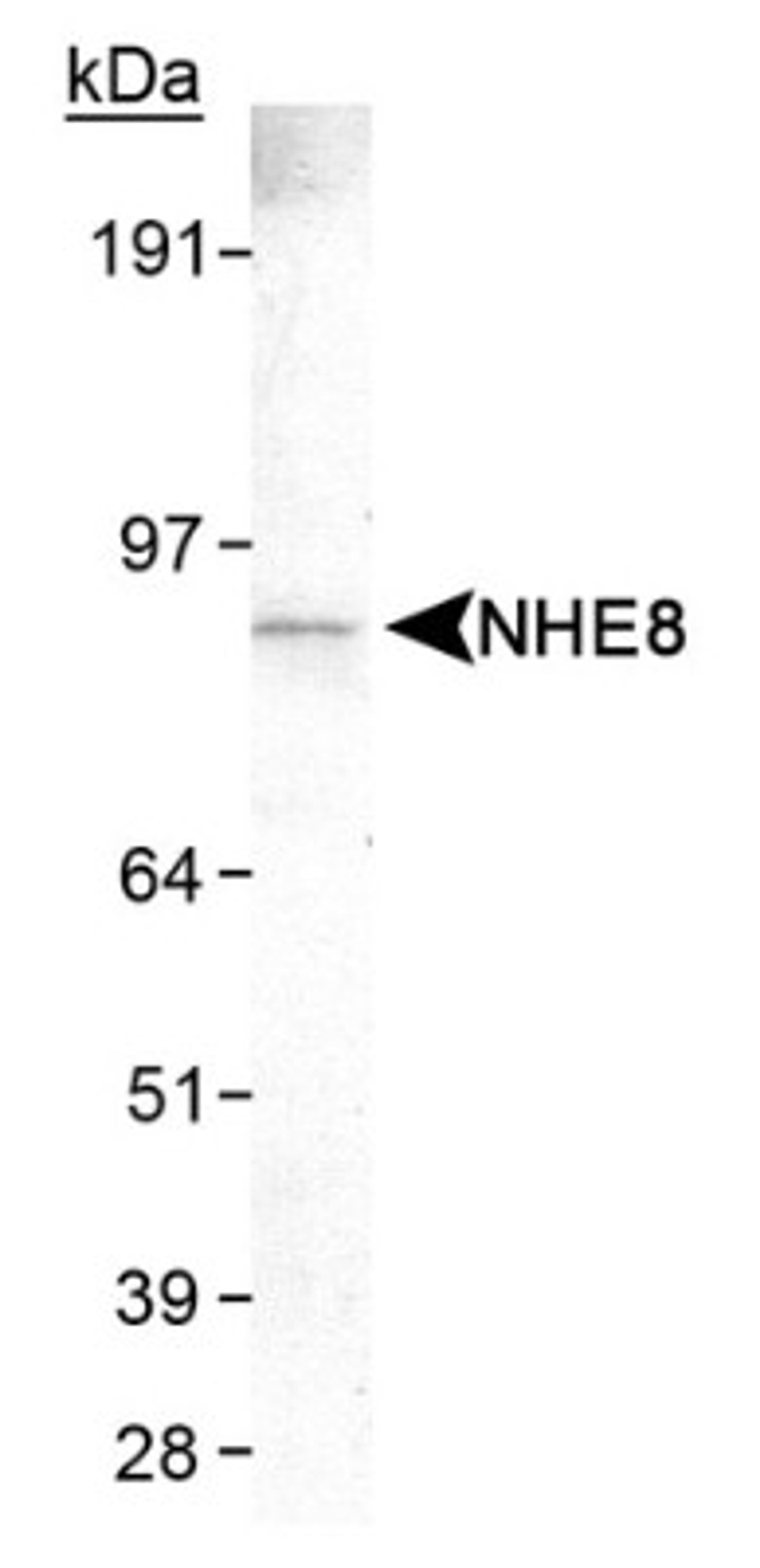 Western Blot: NHE8 Antibody (7A11) [NB110-62091] - Detection of NHE8 (7A11) in HeLa whole cell lysate