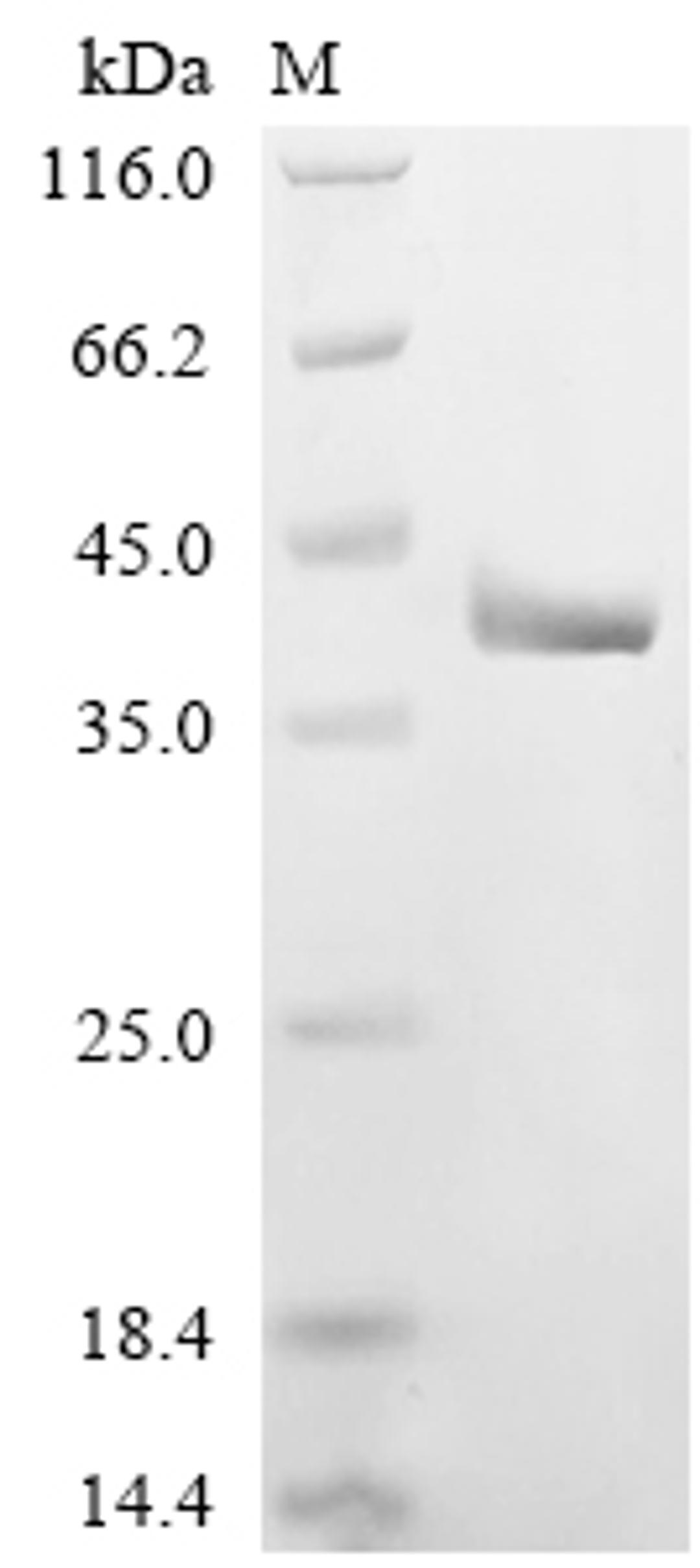 (Tris-Glycine gel) Discontinuous SDS-PAGE (reduced) with 5% enrichment gel and 15% separation gel.