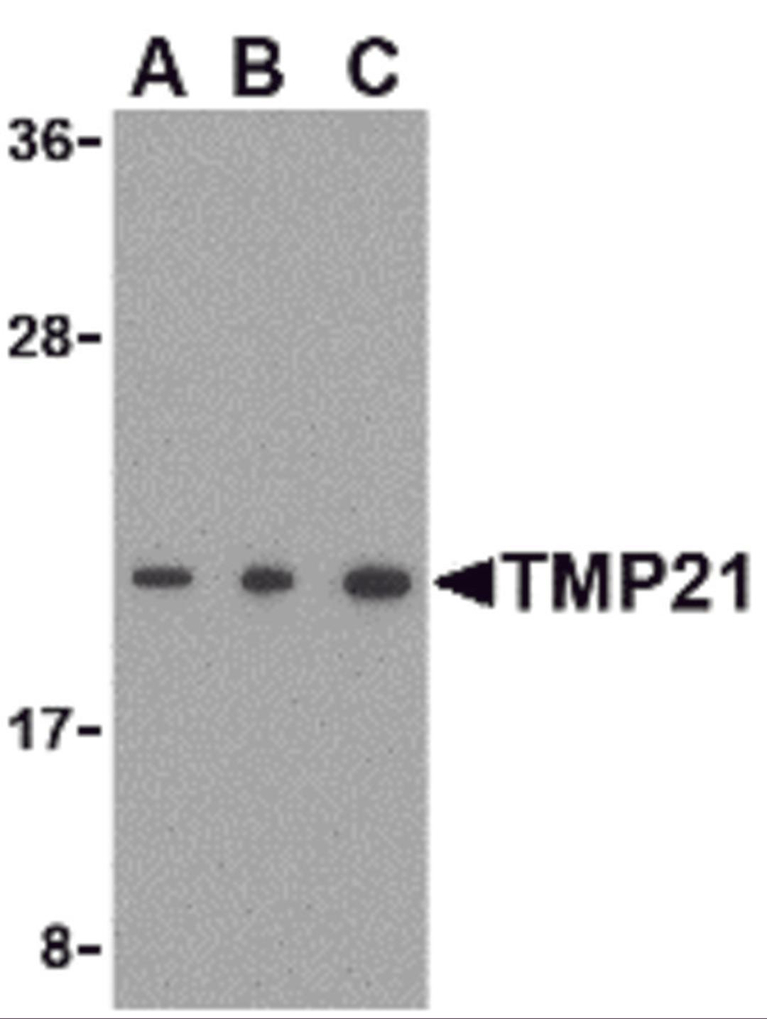 Western blot analysis of TMP21 in Raji cell lysate with TMP21 antibody at (A) 0.5 and (B) 1 and (C) 2 μg/mL.