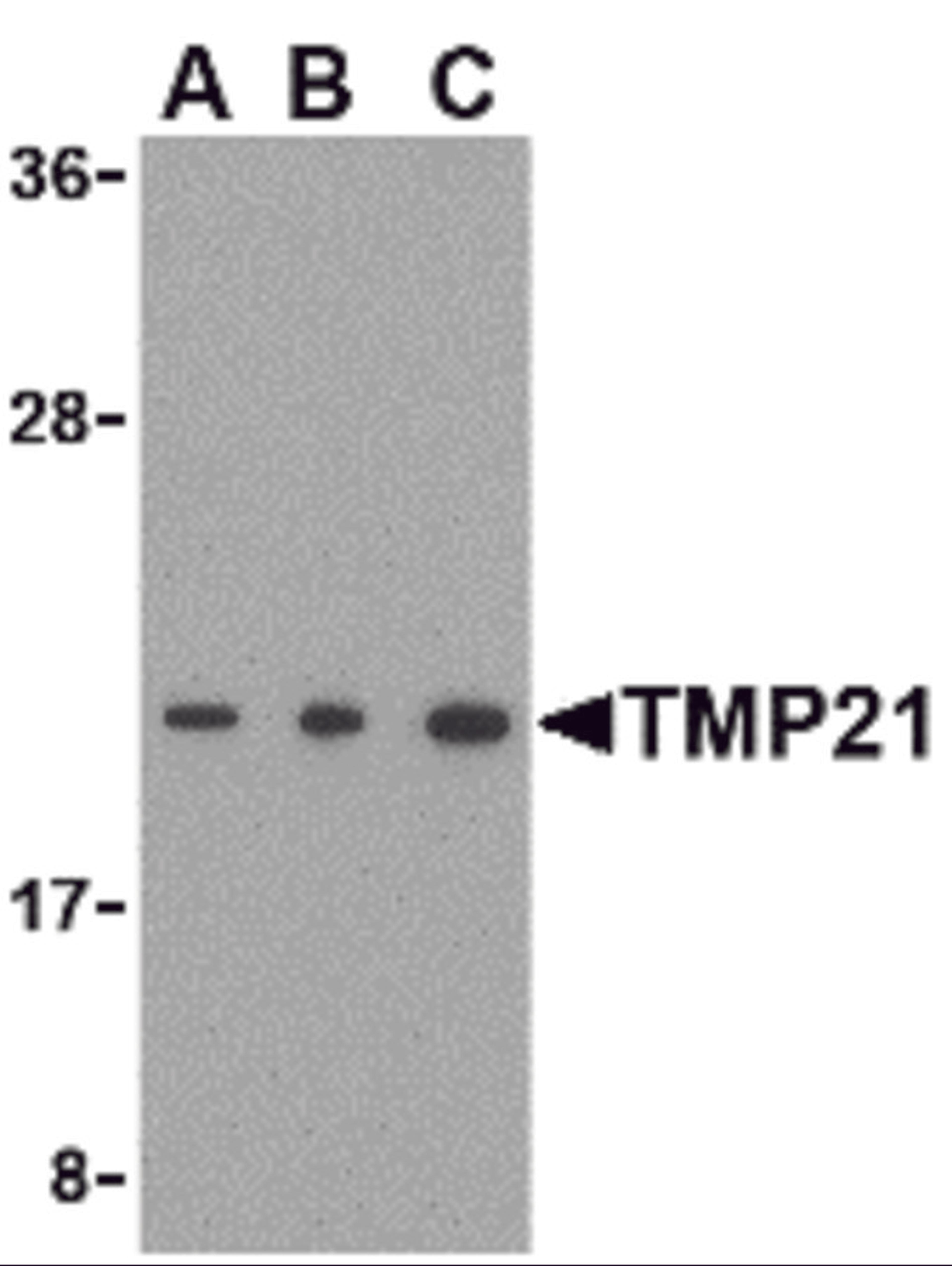 Western blot analysis of TMP21 in Raji cell lysate with TMP21 antibody at (A) 0.5 and (B) 1 and (C) 2 μg/mL.