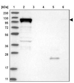 Western Blot: DHX36 Antibody [NBP1-84286] - Lane 1: Marker [kDa] 230, 130, 95, 72, 56, 36, 28, 17, 11<br/>Lane 2: Human cell line RT-4<br/>Lane 3: Human cell line U-251MG sp<br/>Lane 4: Human plasma (IgG/HSA depleted)<br/>Lane 5: Human liver tissue<br/>Lane 6: Human tonsil tissue