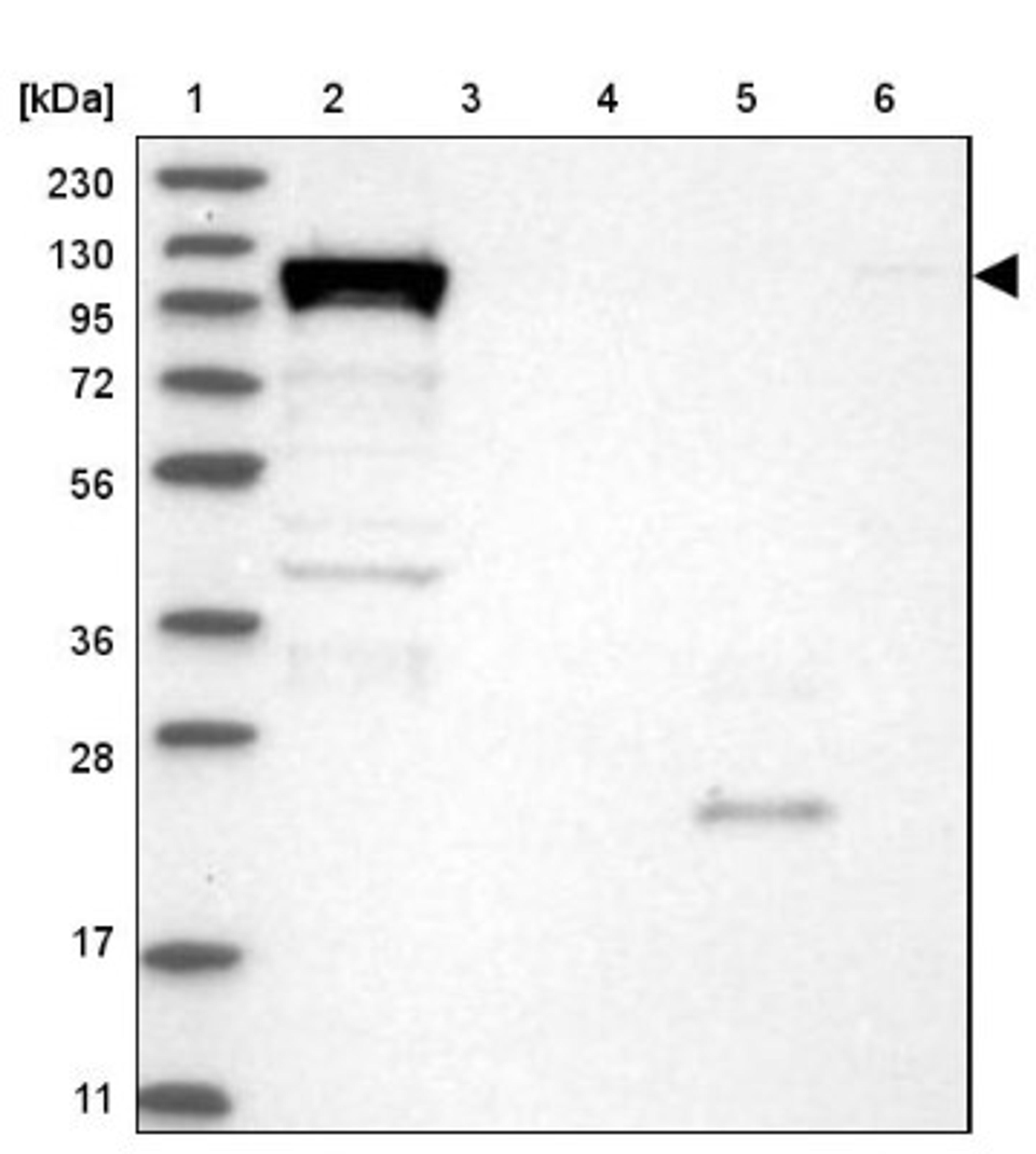 Western Blot: DHX36 Antibody [NBP1-84286] - Lane 1: Marker [kDa] 230, 130, 95, 72, 56, 36, 28, 17, 11<br/>Lane 2: Human cell line RT-4<br/>Lane 3: Human cell line U-251MG sp<br/>Lane 4: Human plasma (IgG/HSA depleted)<br/>Lane 5: Human liver tissue<br/>Lane 6: Human tonsil tissue