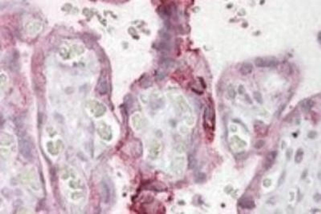 Immunohistochemistry-Paraffin: UBE2F/NCE2 Antibody [NBP1-44062] - Staining of Human Placenta shows membrane staining in trophoblasts.