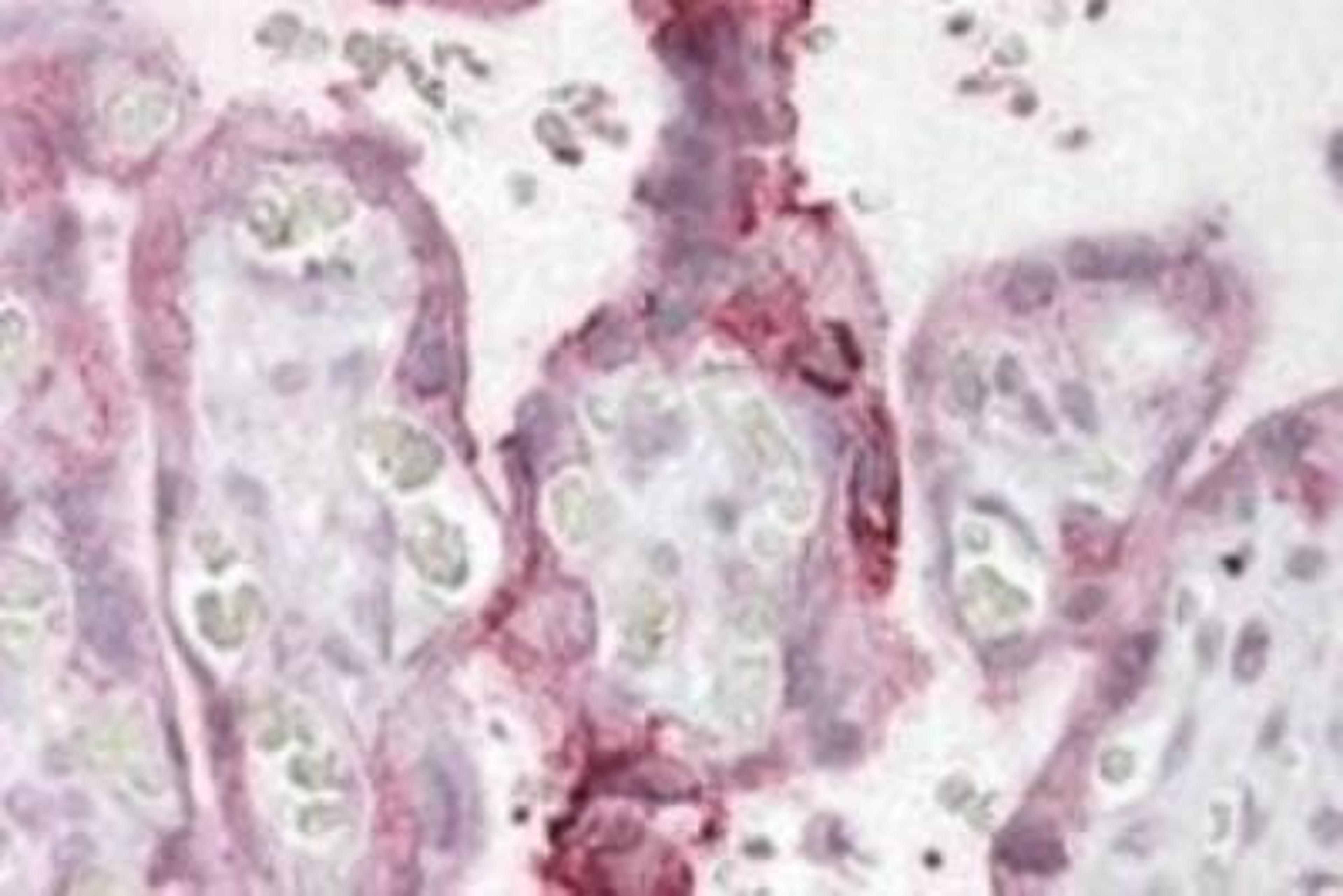 Immunohistochemistry-Paraffin: UBE2F/NCE2 Antibody [NBP1-44062] - Staining of Human Placenta shows membrane staining in trophoblasts.