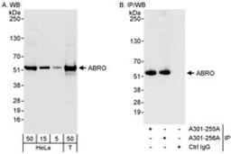 Detection of human ABRO by western blot and immunoprecipitation.