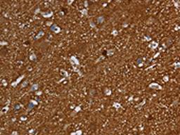 The image is immunohistochemistry of paraffin-embedded Human brain tissue using CSB-PA580970(SNCG Antibody) at dilution 1/60. (Original magnification: ×200)