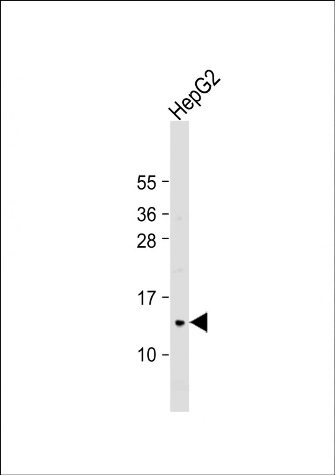 Western Blot at 1:1000 dilution + HepG2 whole cell lysate Lysates/proteins at 20 ug per lane.