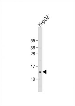 Western Blot at 1:1000 dilution + HepG2 whole cell lysate Lysates/proteins at 20 ug per lane.