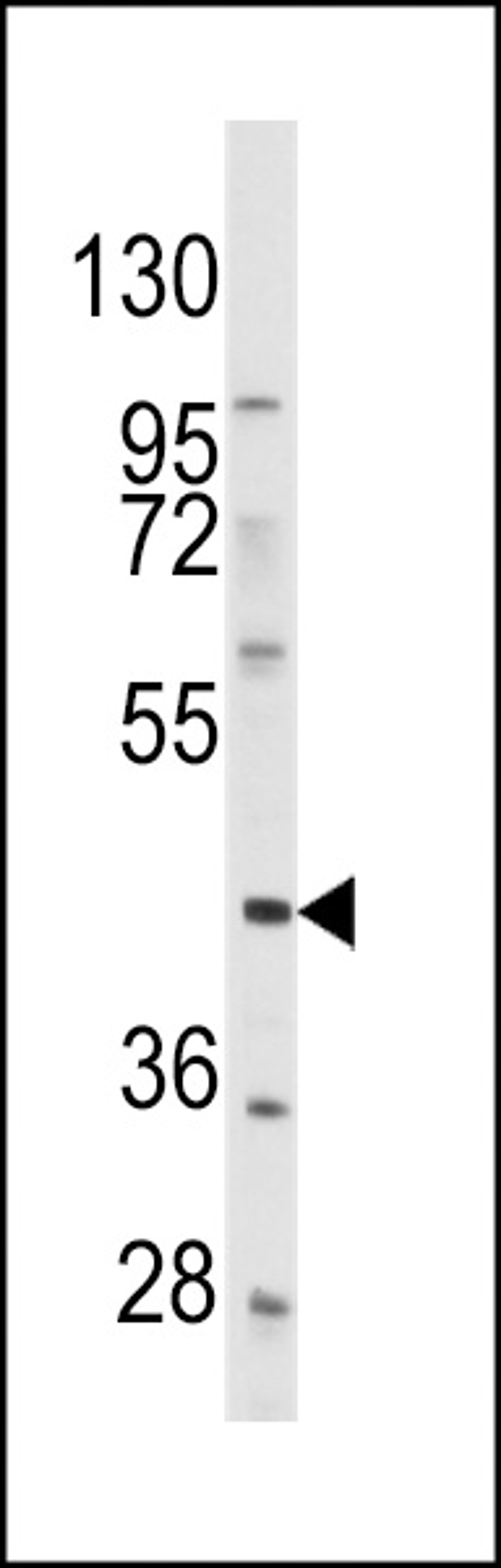 Western blot analysis of anti-PDGFRL Antibody in Hela cell line lysates (35ug/lane).