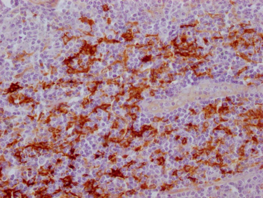 IHC image of CSB-MA179751 diluted at 1:100 and staining in paraffin-embedded human tonsil tissue performed on a Leica BondTM system. After dewaxing and hydration, antigen retrieval was mediated by high pressure in a citrate buffer (pH 6.0). Section was blocked with 10% normal goat serum 30min at RT. Then primary antibody (1% BSA) was incubated at 4°C overnight. The primary is detected by a Goat anti-mouse IgG polymer labeled by HRP and visualized using 0.05% DAB.