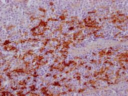 IHC image of CSB-MA179751 diluted at 1:100 and staining in paraffin-embedded human tonsil tissue performed on a Leica BondTM system. After dewaxing and hydration, antigen retrieval was mediated by high pressure in a citrate buffer (pH 6.0). Section was blocked with 10% normal goat serum 30min at RT. Then primary antibody (1% BSA) was incubated at 4°C overnight. The primary is detected by a Goat anti-mouse IgG polymer labeled by HRP and visualized using 0.05% DAB.