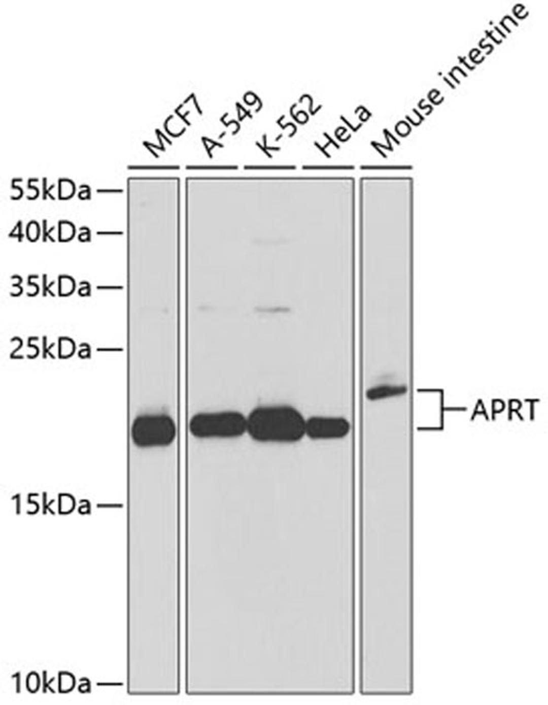 Western blot - APRT antibody (A13946)