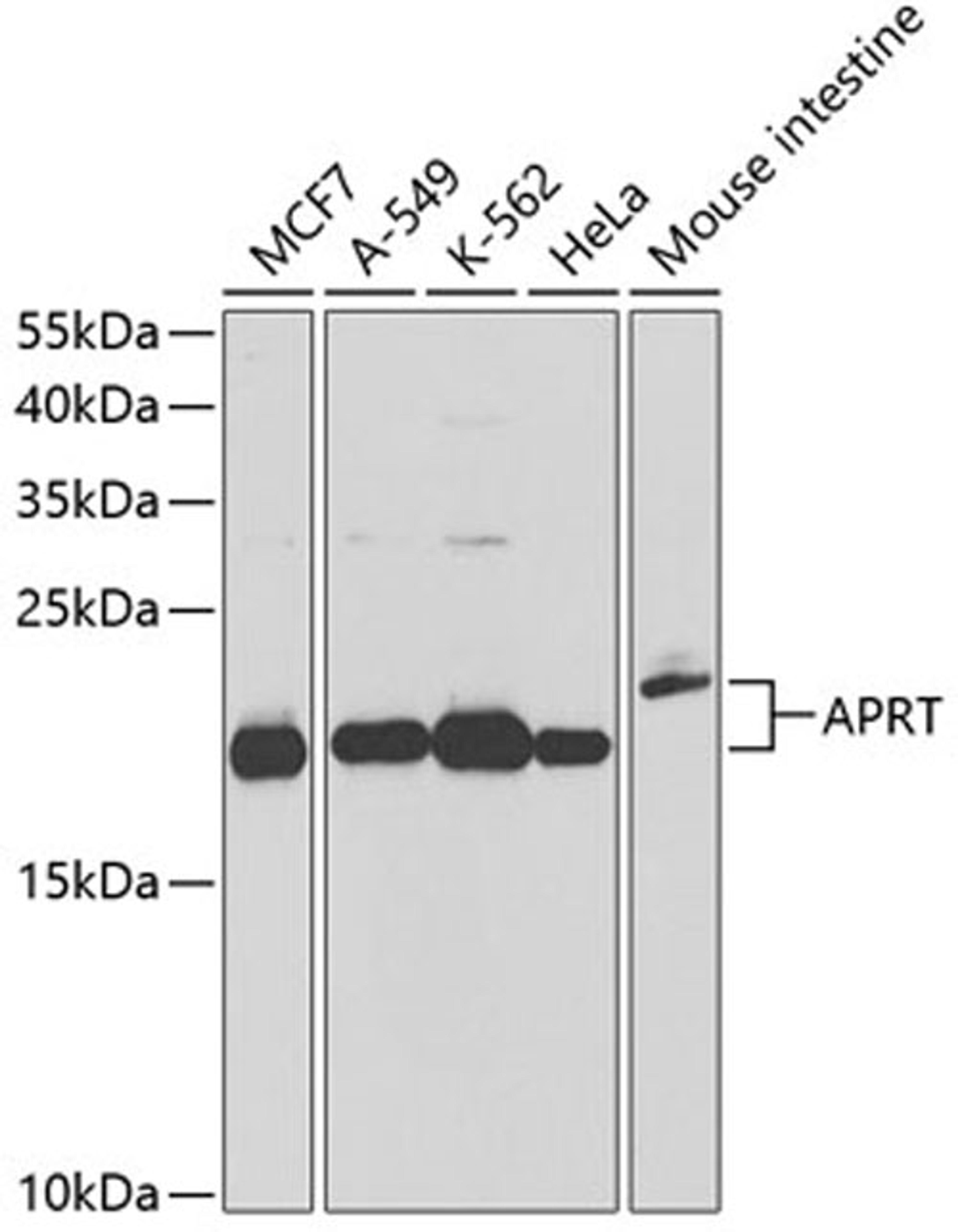 Western blot - APRT antibody (A13946)