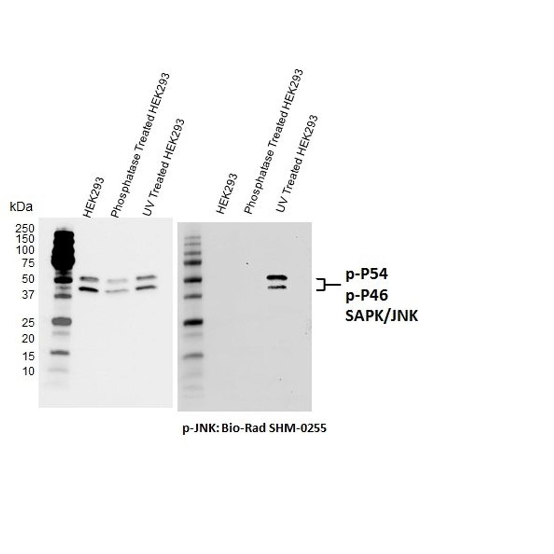 Western blot analysis of total (left) and T183/Y185 phosphorylated (right) JNK. 