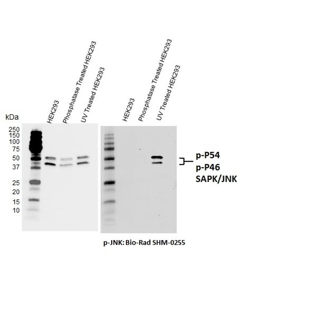 Western blot analysis of total (left) and T183/Y185 phosphorylated (right) JNK.