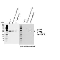 Western blot analysis of total (left) and T183/Y185 phosphorylated (right) JNK.
