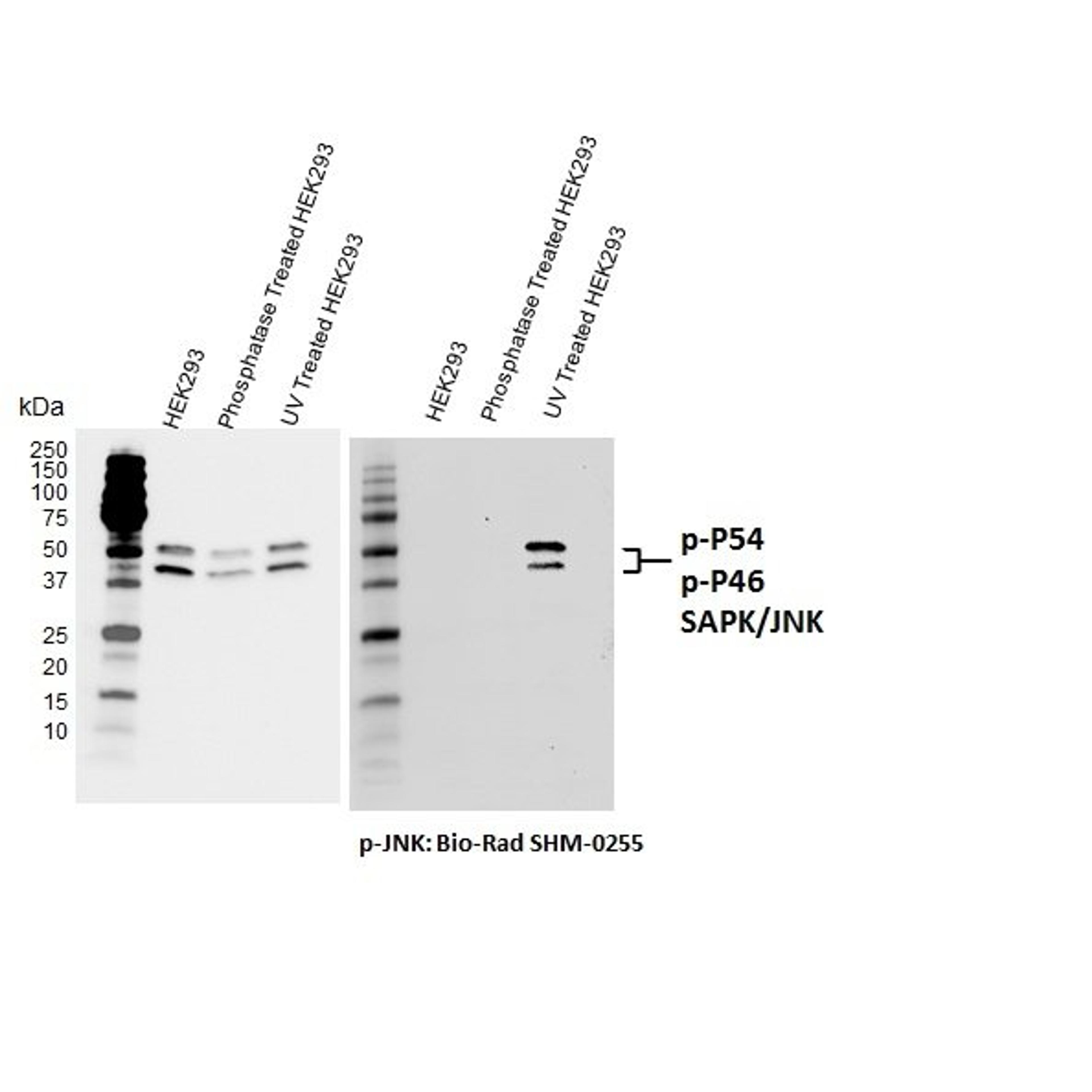 Western blot analysis of total (left) and T183/Y185 phosphorylated (right) JNK.