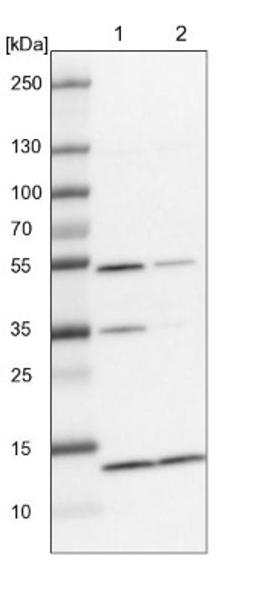 Western Blot: SLAIN1 Antibody [NBP1-88400] - Lane 1: NIH-3T3 cell lysate (Mouse embryonic fibroblast cells)<br/>Lane 2: NBT-II cell lysate (Rat Wistar bladder tumour cells)