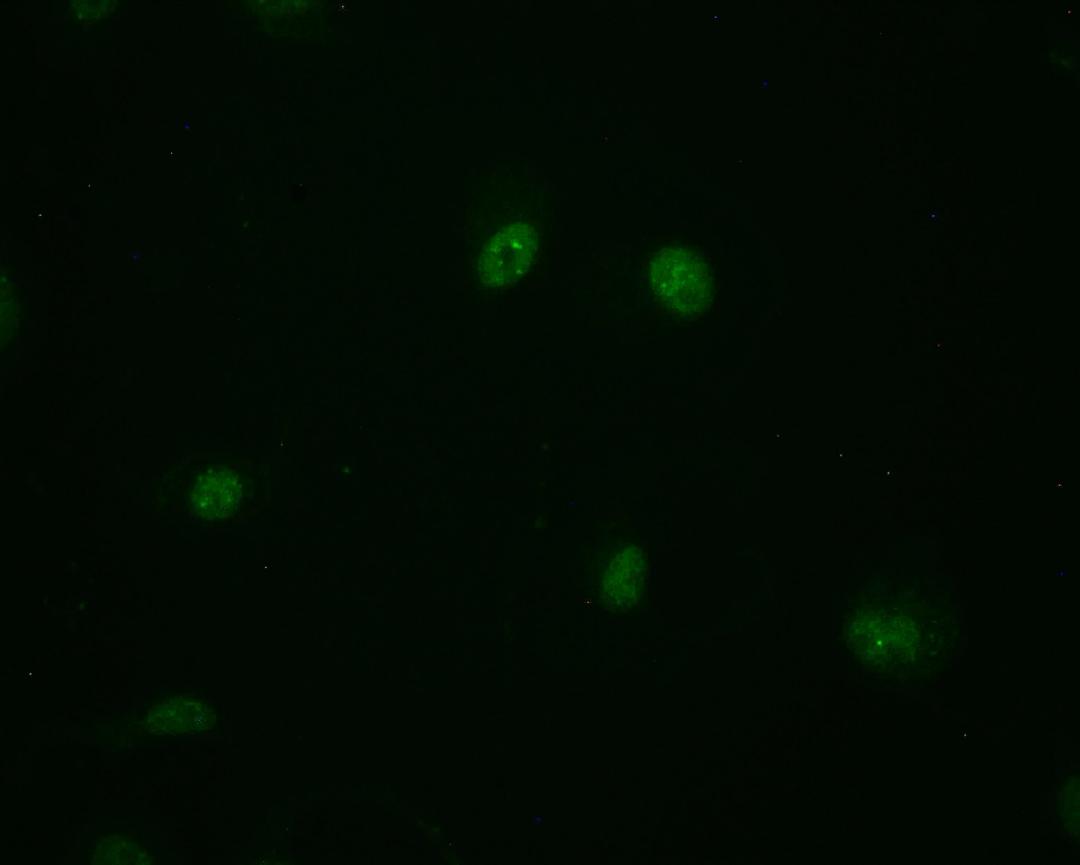 Immunofluorescence staining of MCF-7 cell with CSB-RA794480A0HU at 1:50, counter-stained with DAPI. The cells were fixed in 4% formaldehyde and blocked in 10% normal Goat Serum. The cells were then incubated with the antibody overnight at 4°C. The secondary antibody was Alexa Fluor 498-congugated AffiniPure Goat Anti-Rabbit IgG(H+L).