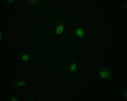 Immunofluorescence staining of MCF-7 cell with CSB-RA794480A0HU at 1:50, counter-stained with DAPI. The cells were fixed in 4% formaldehyde and blocked in 10% normal Goat Serum. The cells were then incubated with the antibody overnight at 4°C. The secondary antibody was Alexa Fluor 498-congugated AffiniPure Goat Anti-Rabbit IgG(H+L).