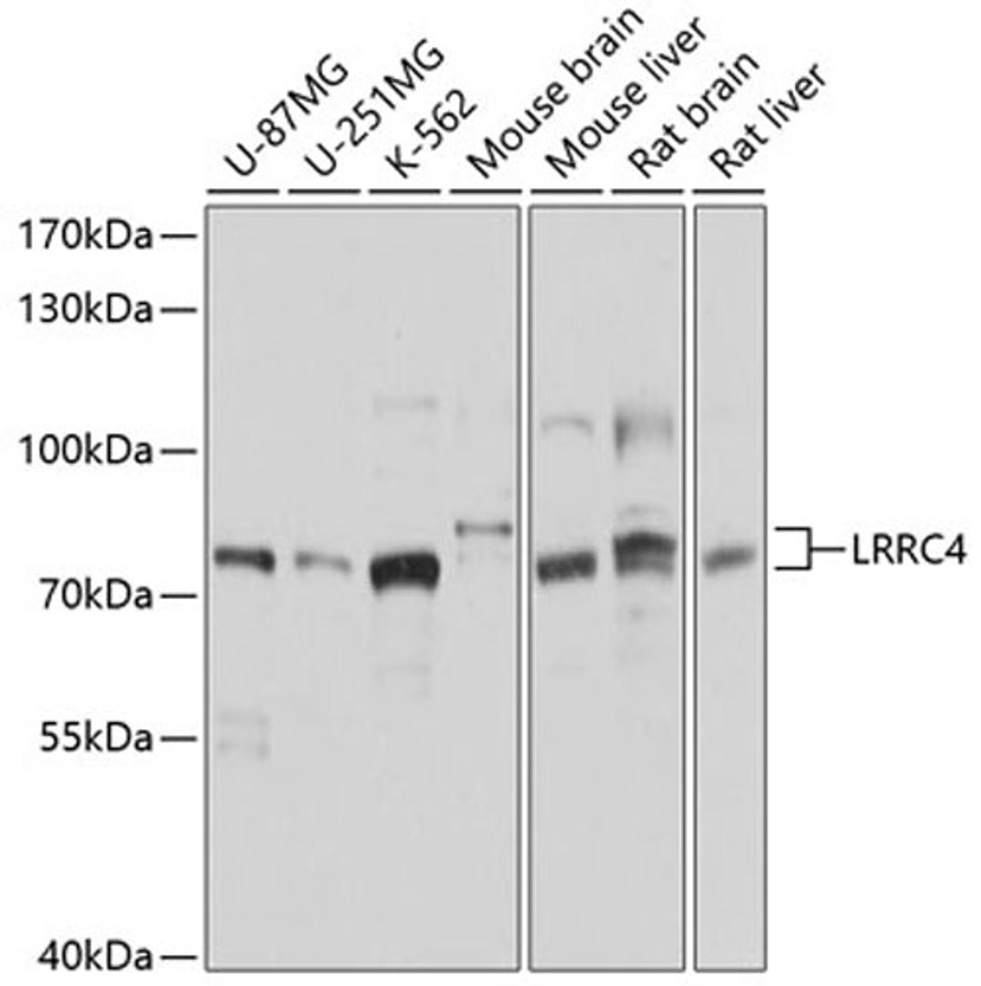 Western blot - LRRC4 antibody (A10321)