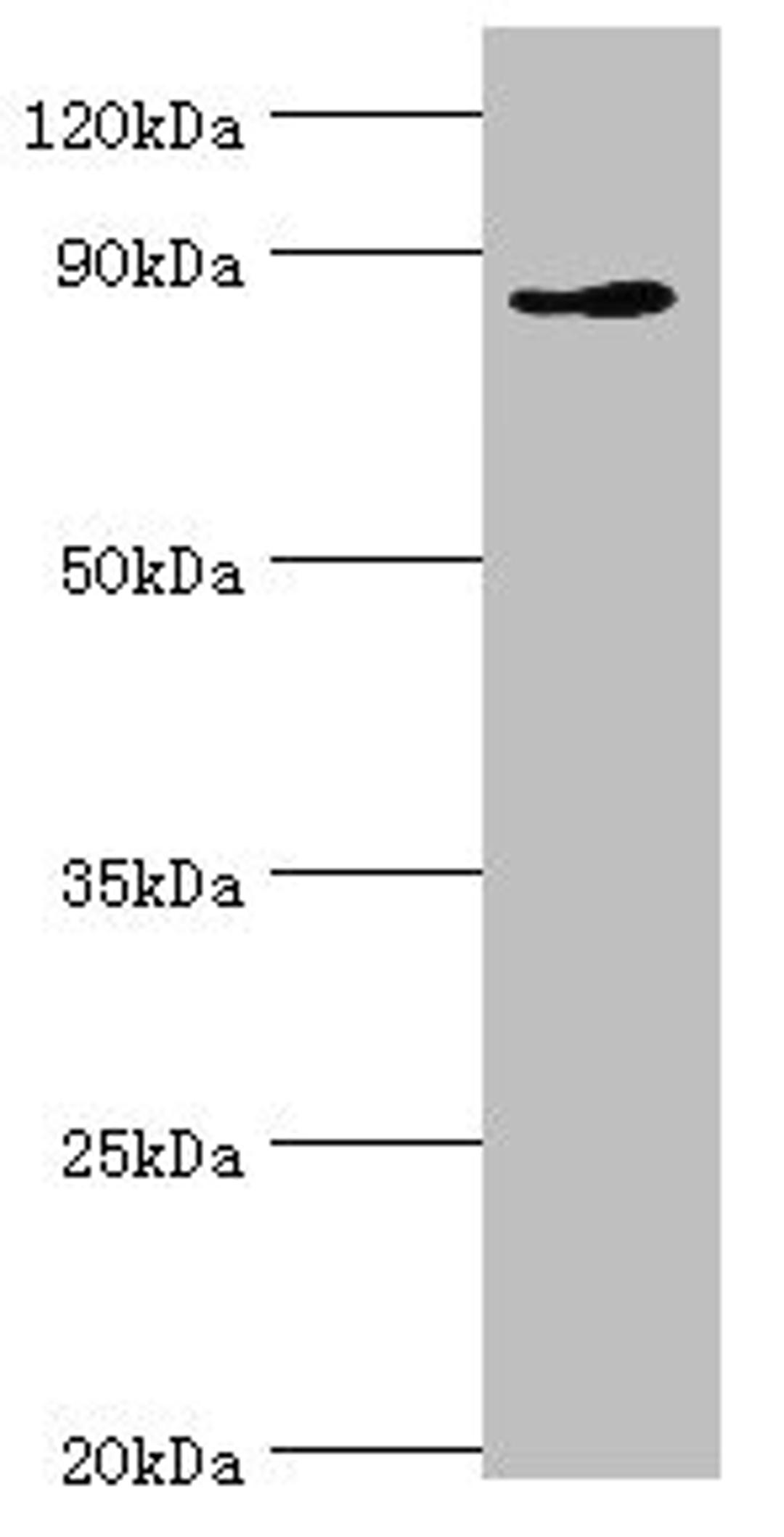 Western blot. All lanes: CDH11 antibody at 6ug/ml + Jurkat whole cell lysate. Secondary. Goat polyclonal to rabbit IgG at 1/10000 dilution. Predicted band size: 88, 77 kDa. Observed band size: 88 kDa.