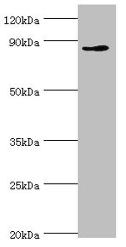 Western blot. All lanes: CDH11 antibody at 6ug/ml + Jurkat whole cell lysate. Secondary. Goat polyclonal to rabbit IgG at 1/10000 dilution. Predicted band size: 88, 77 kDa. Observed band size: 88 kDa.