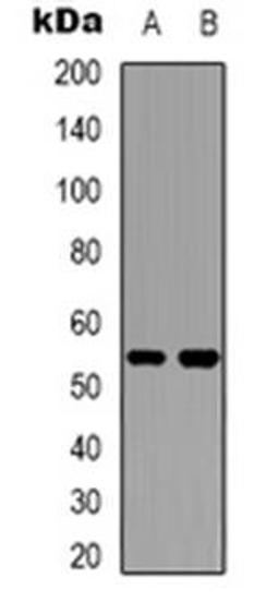 Western blot analysis of Cytochrome P450 2W1 expression in Hela (Lane 1), HepG2 (Lane 2) whole cell lysates using CYP2W1 antibody