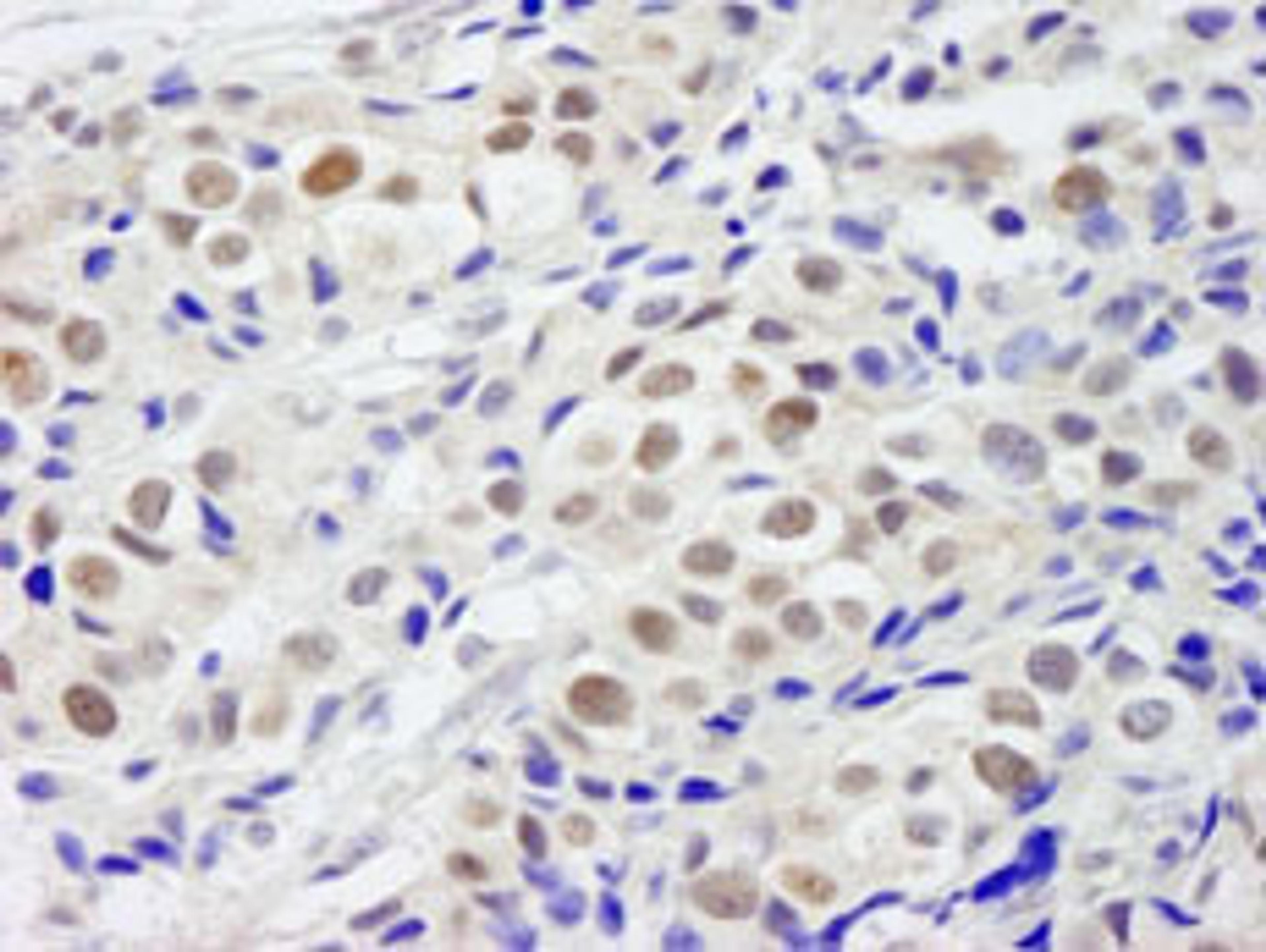 Detection of human PHF6 by immunohistochemistry.