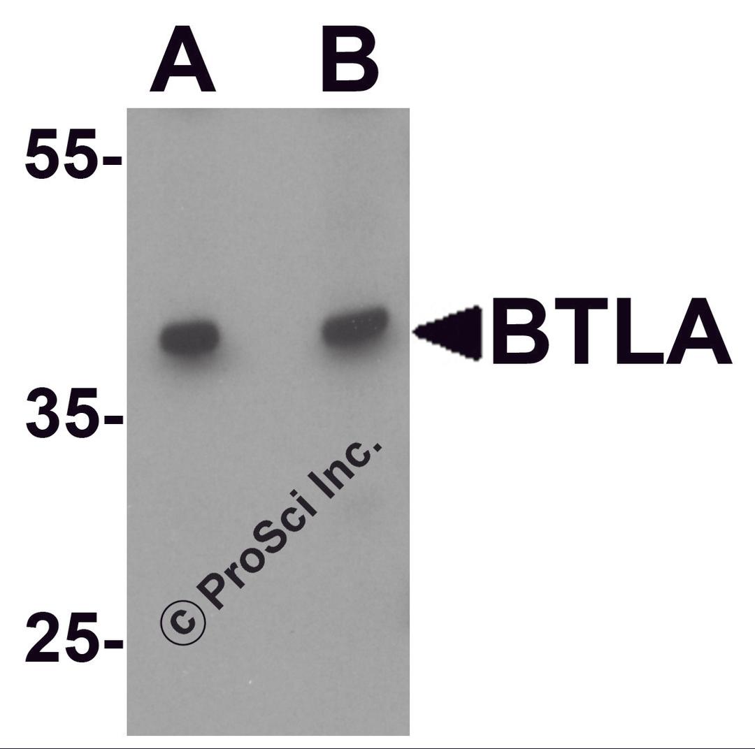 Western blot analysis of BTLA in Jurkat cell lysate at (A) 1 and (B) 2 &#956;g/ml.