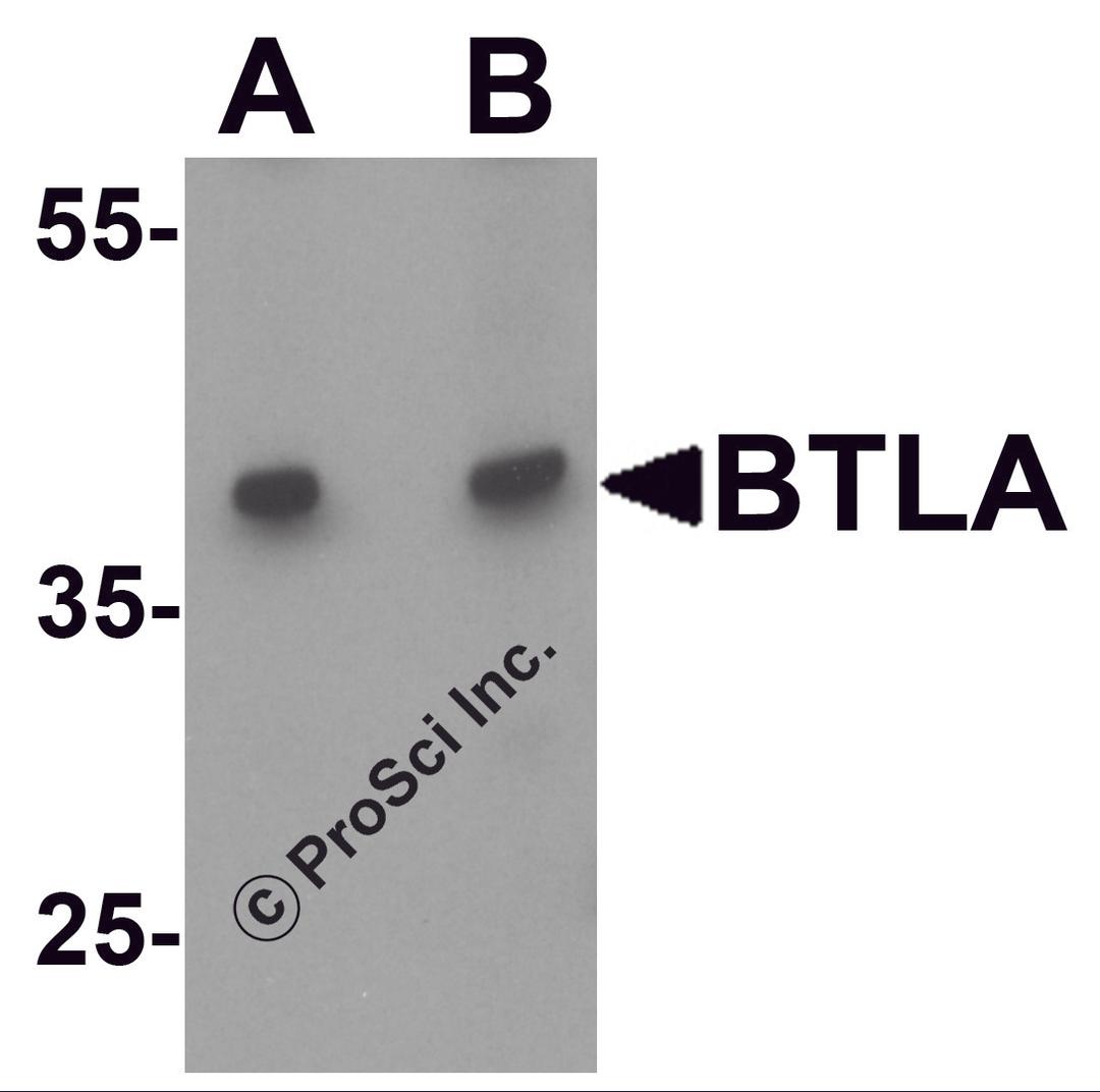 Western blot analysis of BTLA in Jurkat cell lysate at (A) 1 and (B) 2 μg/ml.
