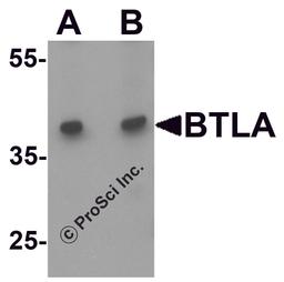 Western blot analysis of BTLA in Jurkat cell lysate at (A) 1 and (B) 2 μg/ml.