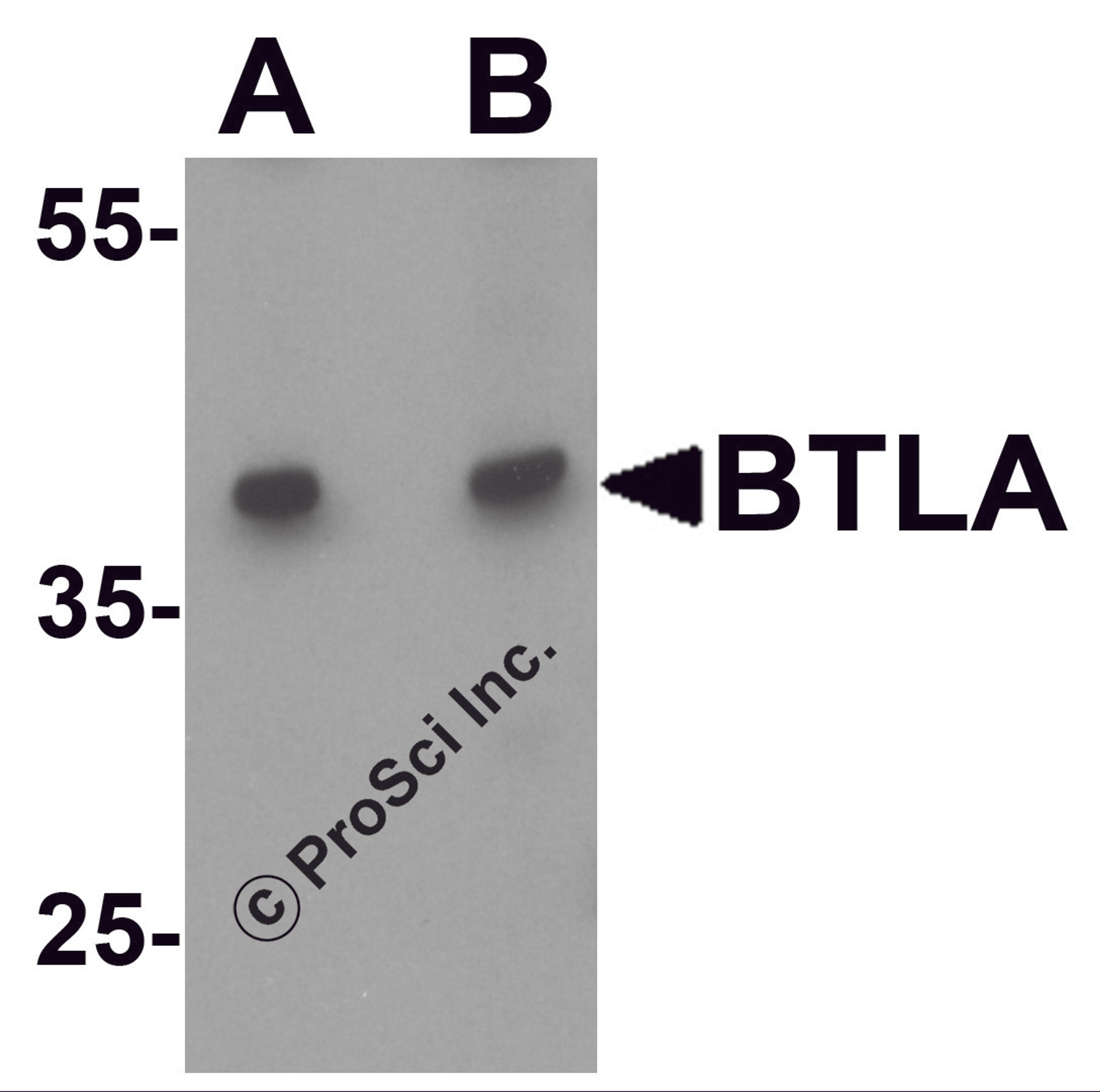 Western blot analysis of BTLA in Jurkat cell lysate at (A) 1 and (B) 2 μg/ml.