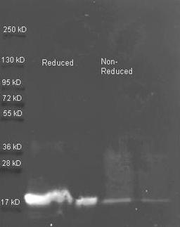 Western blot analysis of used to detect purified Soybean Trypsin Inhibitor using Trypsin Inhibitor antibody