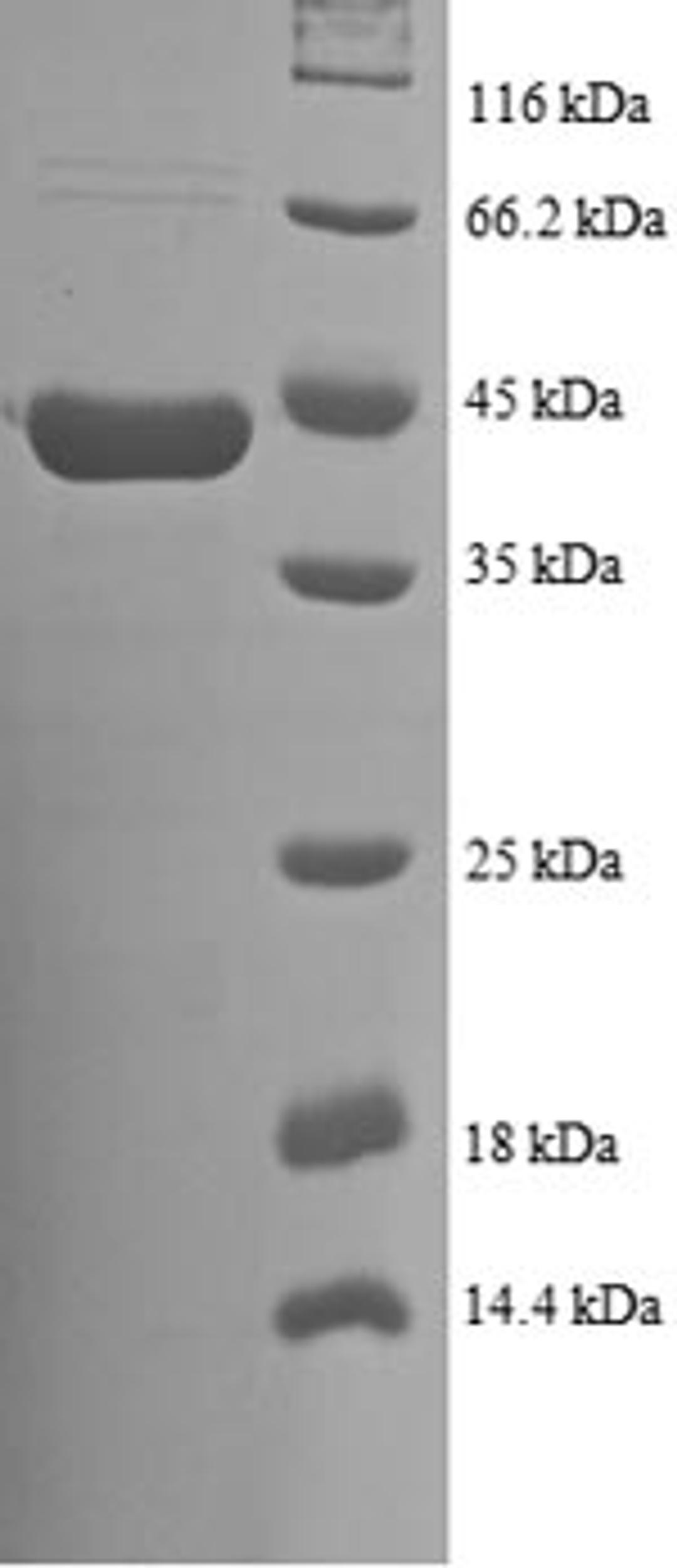 (Tris-Glycine gel) Discontinuous SDS-PAGE (reduced) with 5% enrichment gel and 15% separation gel.