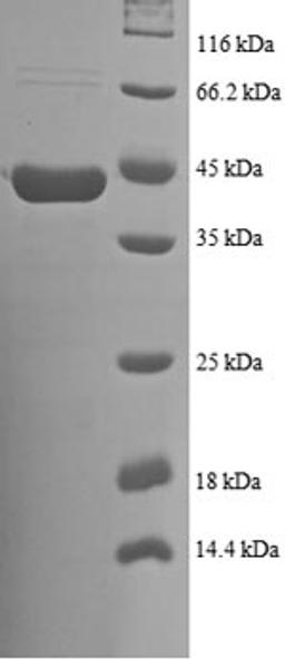 (Tris-Glycine gel) Discontinuous SDS-PAGE (reduced) with 5% enrichment gel and 15% separation gel.