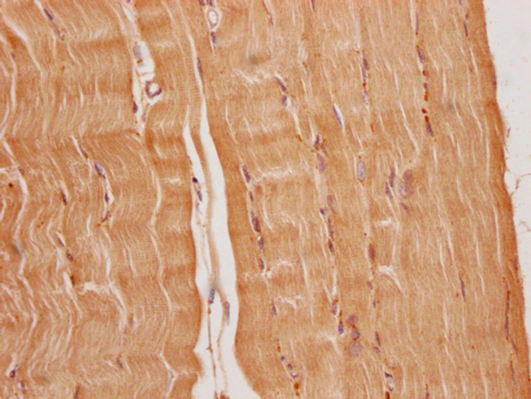 IHC image of CSB-PA836707OA01HU diluted at 1:200 and staining in paraffin-embedded human heart tissue performed on a Leica BondTM system. After dewaxing and hydration, antigen retrieval was mediated by high pressure in a citrate buffer (pH 6.0). Section was blocked with 10% normal goat serum 30min at RT. Then primary antibody (1% BSA) was incubated at 4°C overnight. The primary is detected by a Goat anti-rabbit polymer IgG labeled by HRP and visualized using 0.05% DAB.