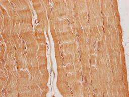 IHC image of CSB-PA836707OA01HU diluted at 1:200 and staining in paraffin-embedded human heart tissue performed on a Leica BondTM system. After dewaxing and hydration, antigen retrieval was mediated by high pressure in a citrate buffer (pH 6.0). Section was blocked with 10% normal goat serum 30min at RT. Then primary antibody (1% BSA) was incubated at 4°C overnight. The primary is detected by a Goat anti-rabbit polymer IgG labeled by HRP and visualized using 0.05% DAB.