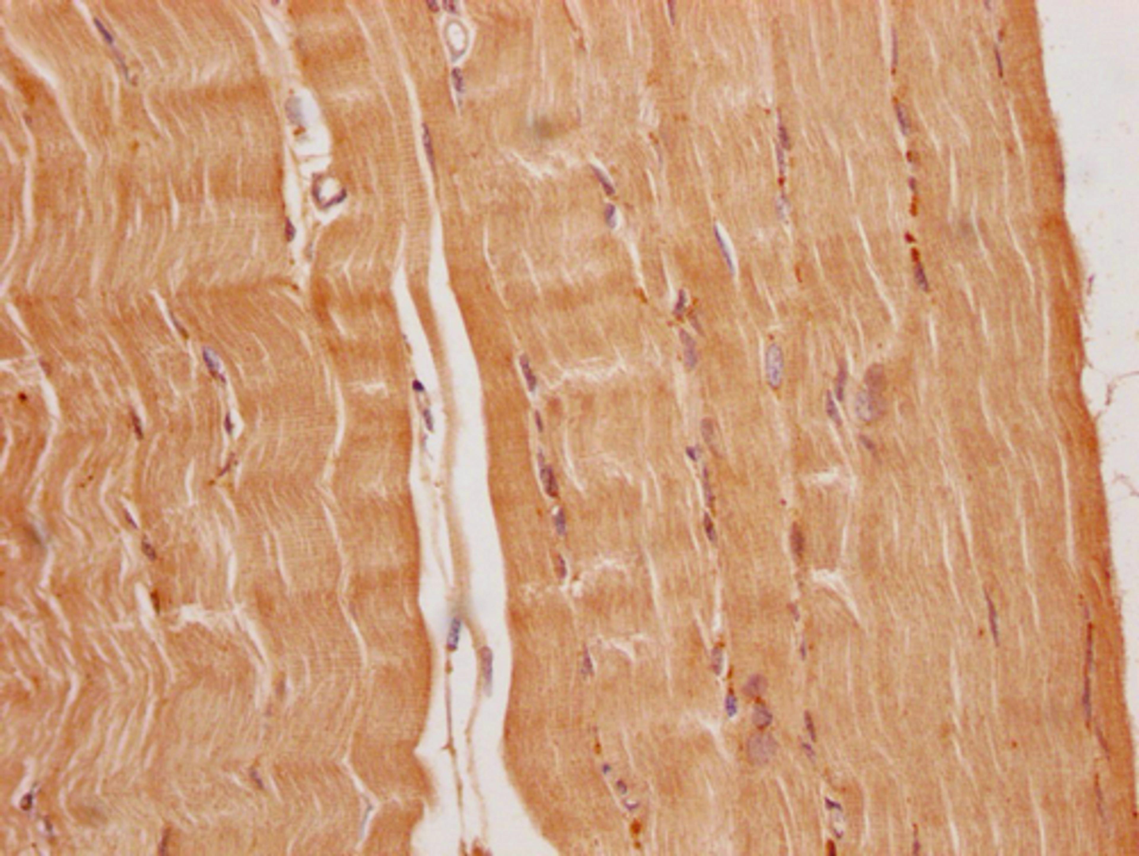 IHC image of CSB-PA836707OA01HU diluted at 1:200 and staining in paraffin-embedded human heart tissue performed on a Leica BondTM system. After dewaxing and hydration, antigen retrieval was mediated by high pressure in a citrate buffer (pH 6.0). Section was blocked with 10% normal goat serum 30min at RT. Then primary antibody (1% BSA) was incubated at 4°C overnight. The primary is detected by a Goat anti-rabbit polymer IgG labeled by HRP and visualized using 0.05% DAB.