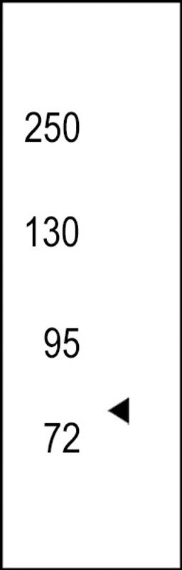 Western blot analysis of hTRKC-C45 in 293 cell line lysates (35ug/lane)