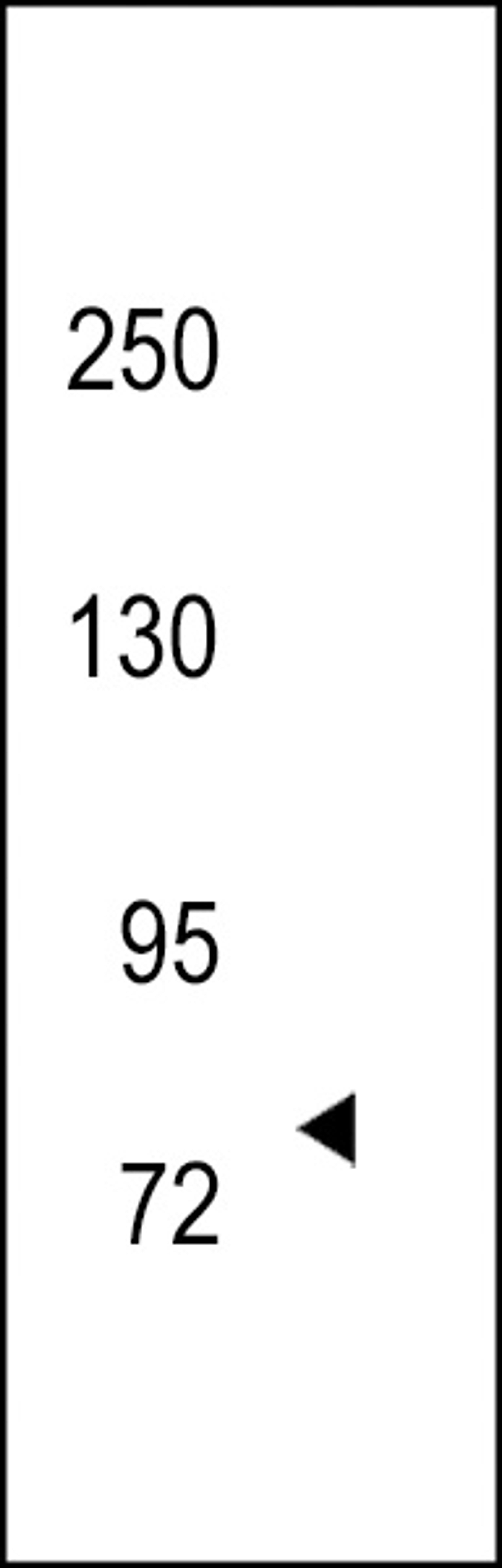 Western blot analysis of hTRKC-C45 in 293 cell line lysates (35ug/lane)