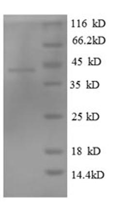 (Tris-Glycine gel) Discontinuous SDS-PAGE (reduced) with 5% enrichment gel and 15% separation gel.