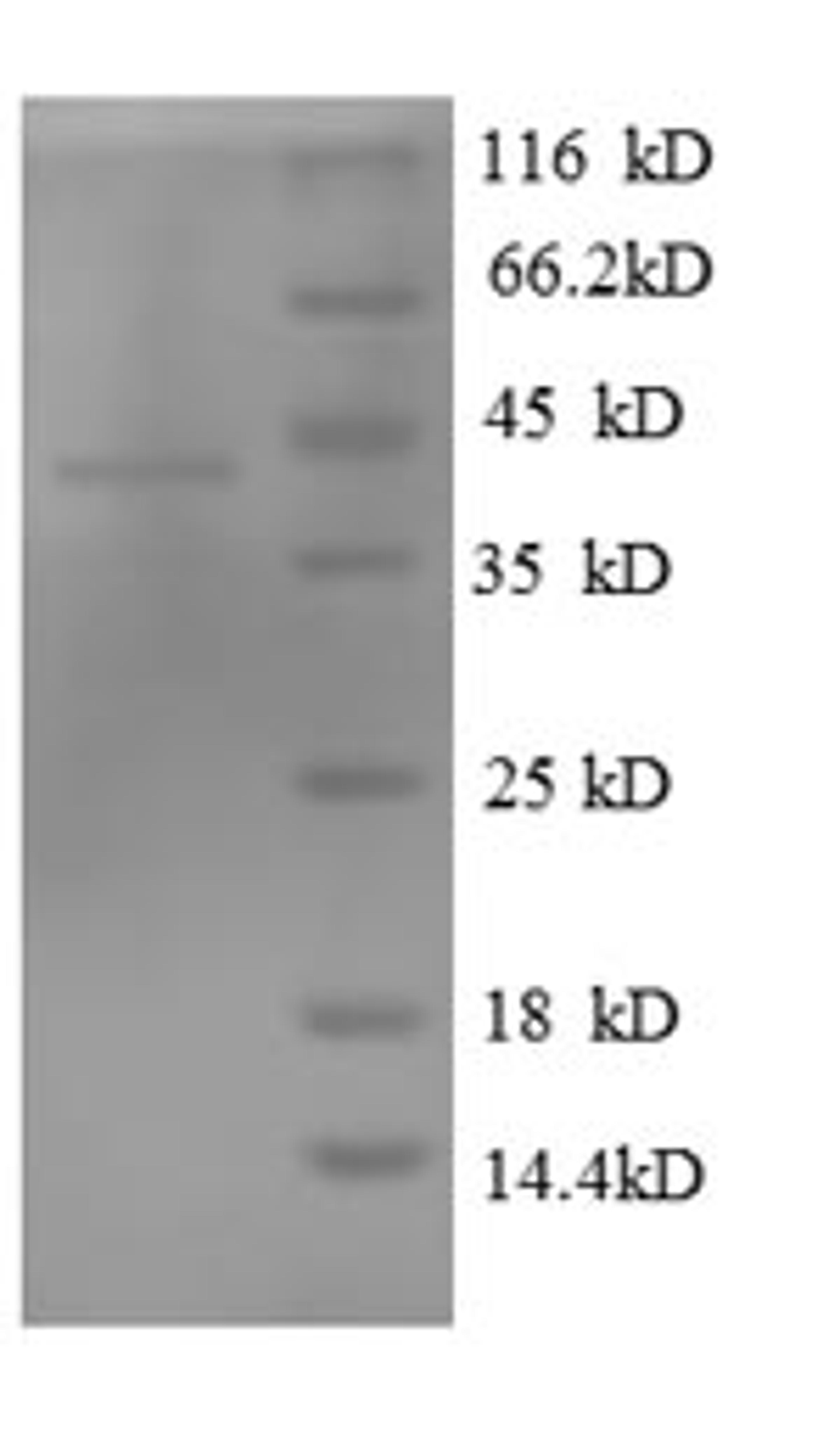 (Tris-Glycine gel) Discontinuous SDS-PAGE (reduced) with 5% enrichment gel and 15% separation gel.