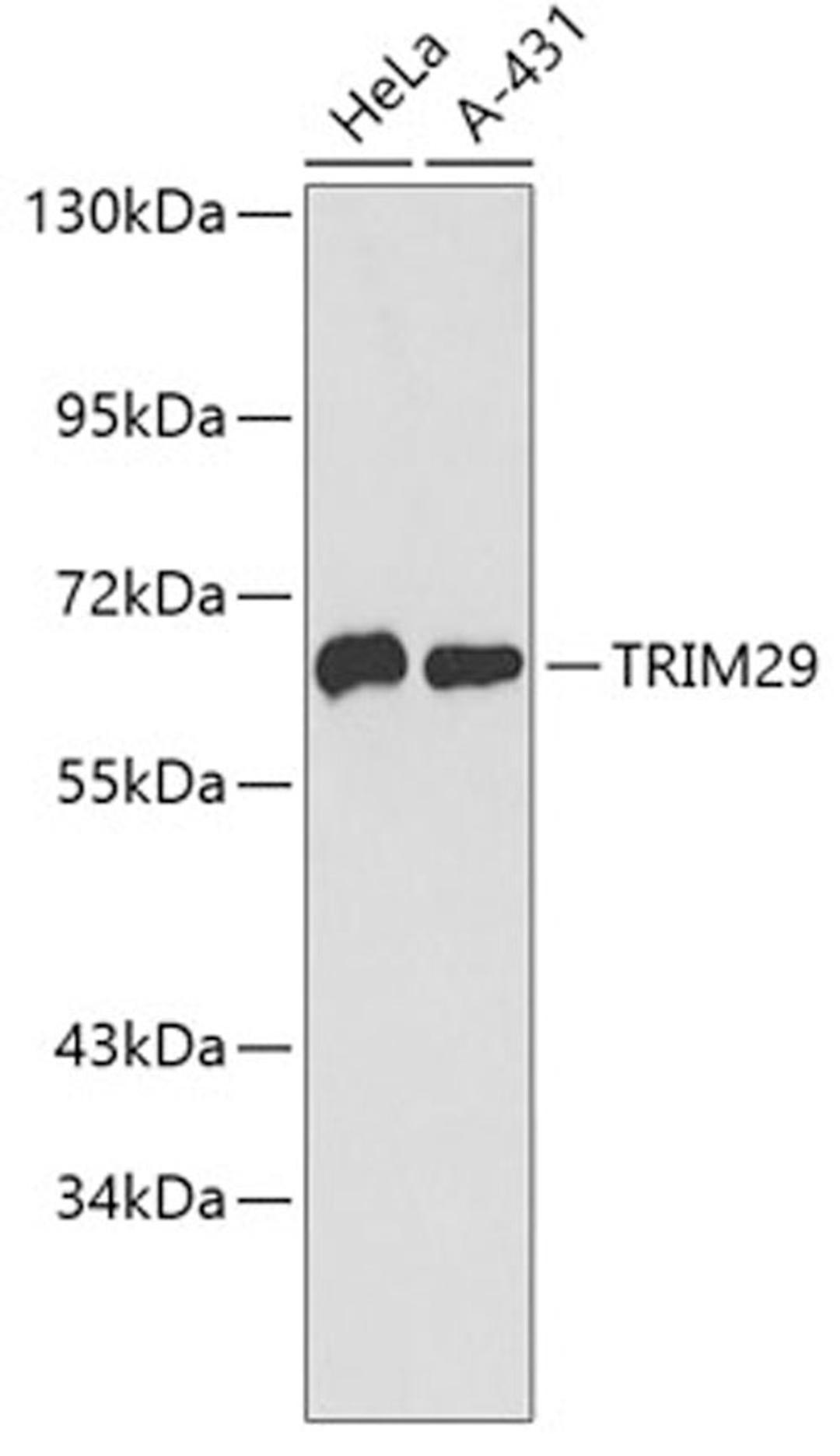 Western blot - TRIM29 antibody (A4576)