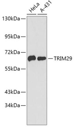 Western blot - TRIM29 antibody (A4576)