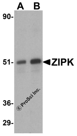 Western blot analysis of ZIP kinase in (A) HeLa and (B) Jurkat lysates with ZIP kinase antibody at 1 &#956;g/mL.