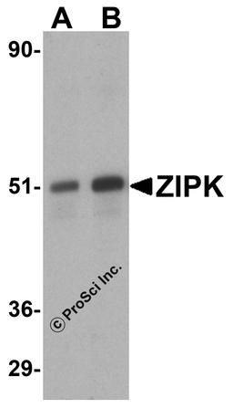 Western blot analysis of ZIP kinase in (A) HeLa and (B) Jurkat lysates with ZIP kinase antibody at 1 μg/mL.